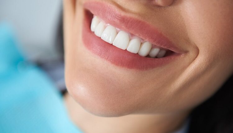 White Spots On Teeth After Braces, Whitening, Or While Sick